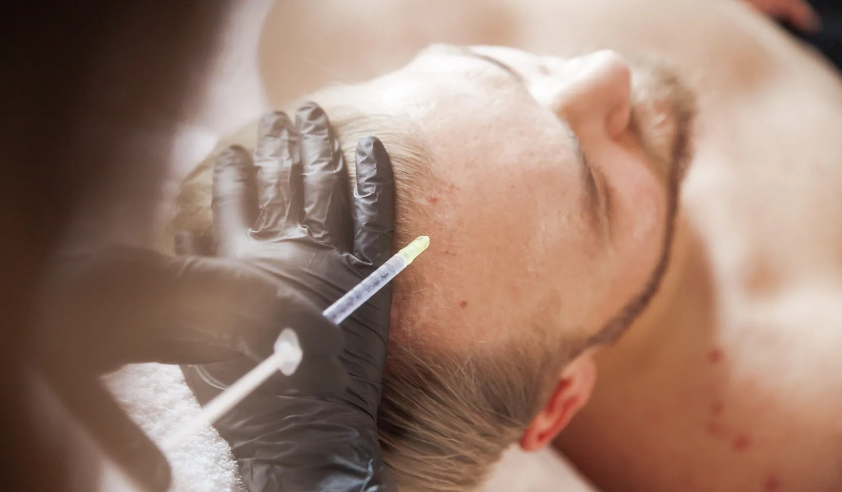 Hautarzt Oberland - Mesotherapie