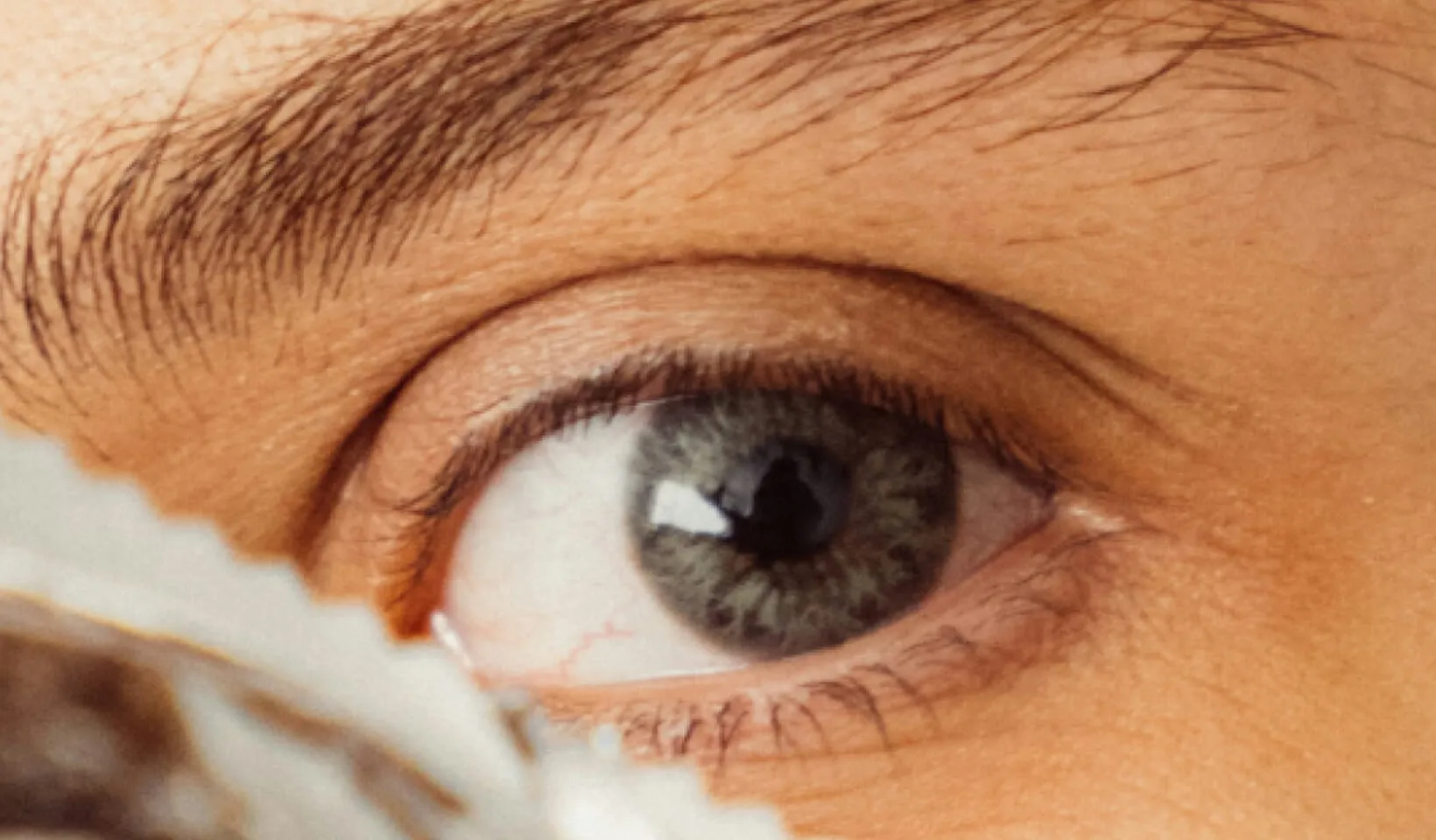 Hautarzt Oberland - Blepharoplastik