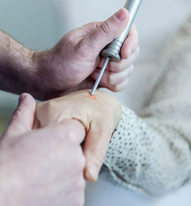 Hautarzt Oberland - Licht- und Lasertherapie