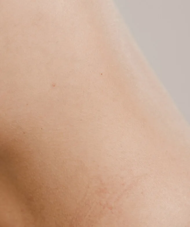 Hautarzt Oberland - Allgemeine Dermatologie