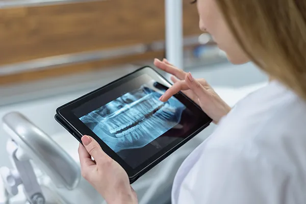 Person reviewing a dental X-ray of teeth on a tablet device in a medical setting.