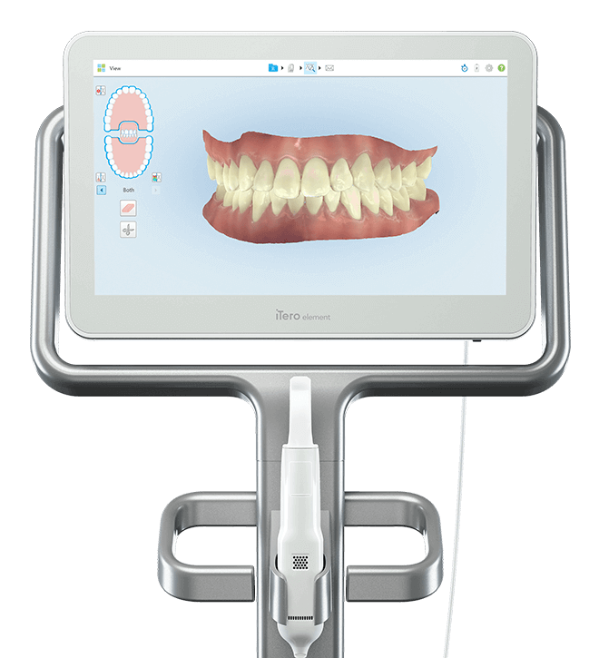 Dental scanner device with a screen displaying a 3D digital model of upper and lower teeth and gums.