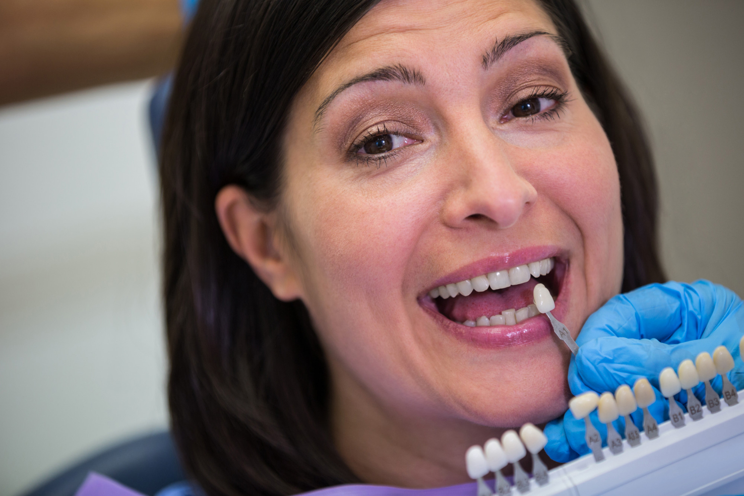 Woman smiling with an open mouth while a dental professional holds a tooth shade guide near her teeth.