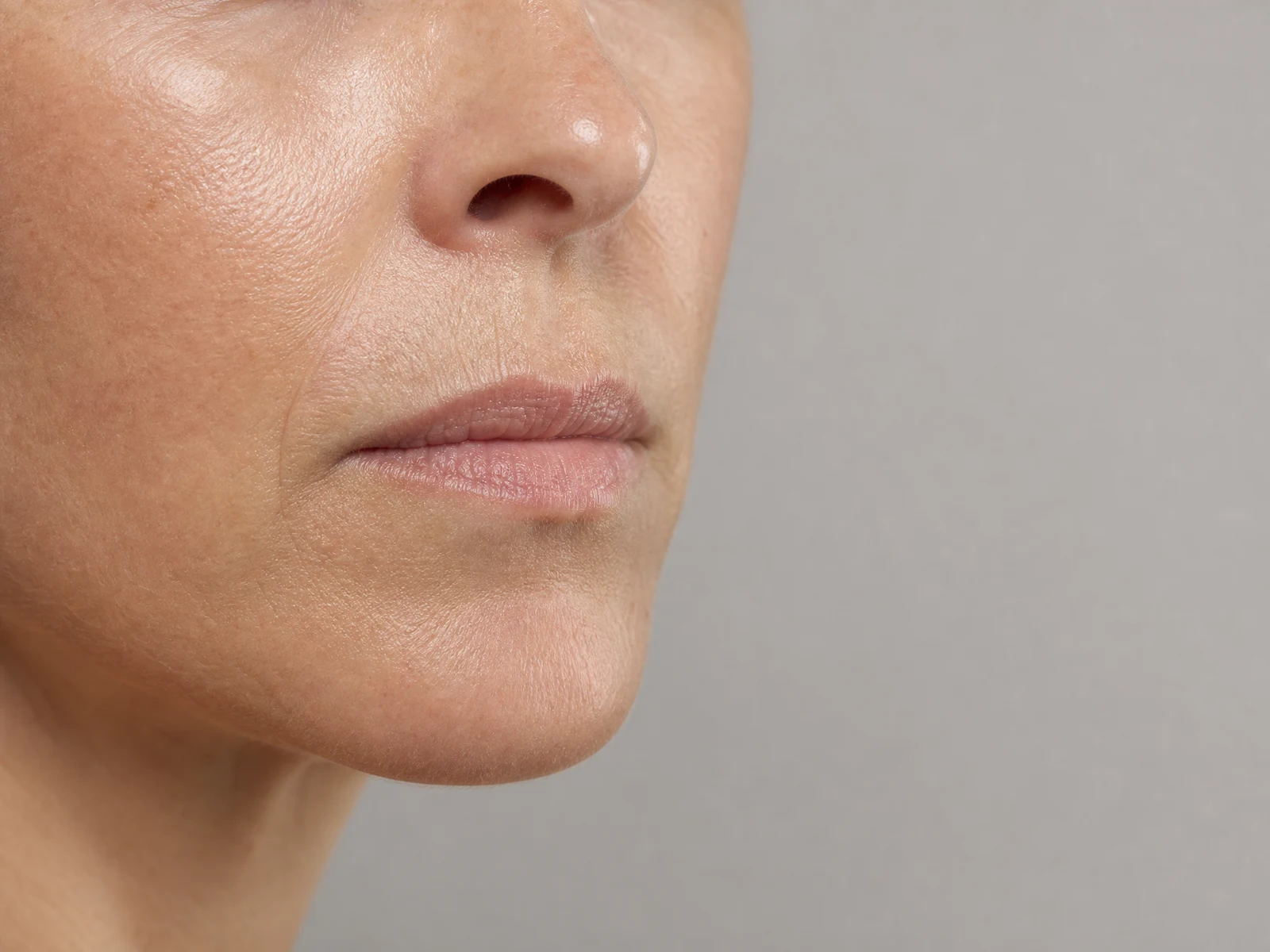 Lippenfältchen periorale Faltenbehandlung – Aesthetikpraxis Aachen