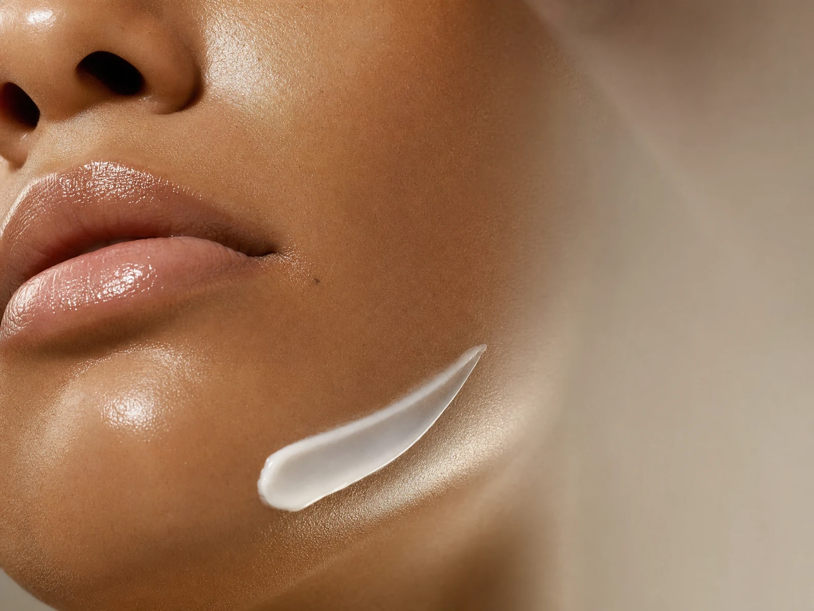 Lippen- und Kinnpartie mit glänzendem Cremestrich auf der Kieferlinie – Hyaluron auflösen, Aesthetikpraxis Aachen