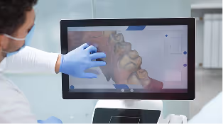 Dental office setup with a monitor displaying dental X-rays and dental tools in the foreground.