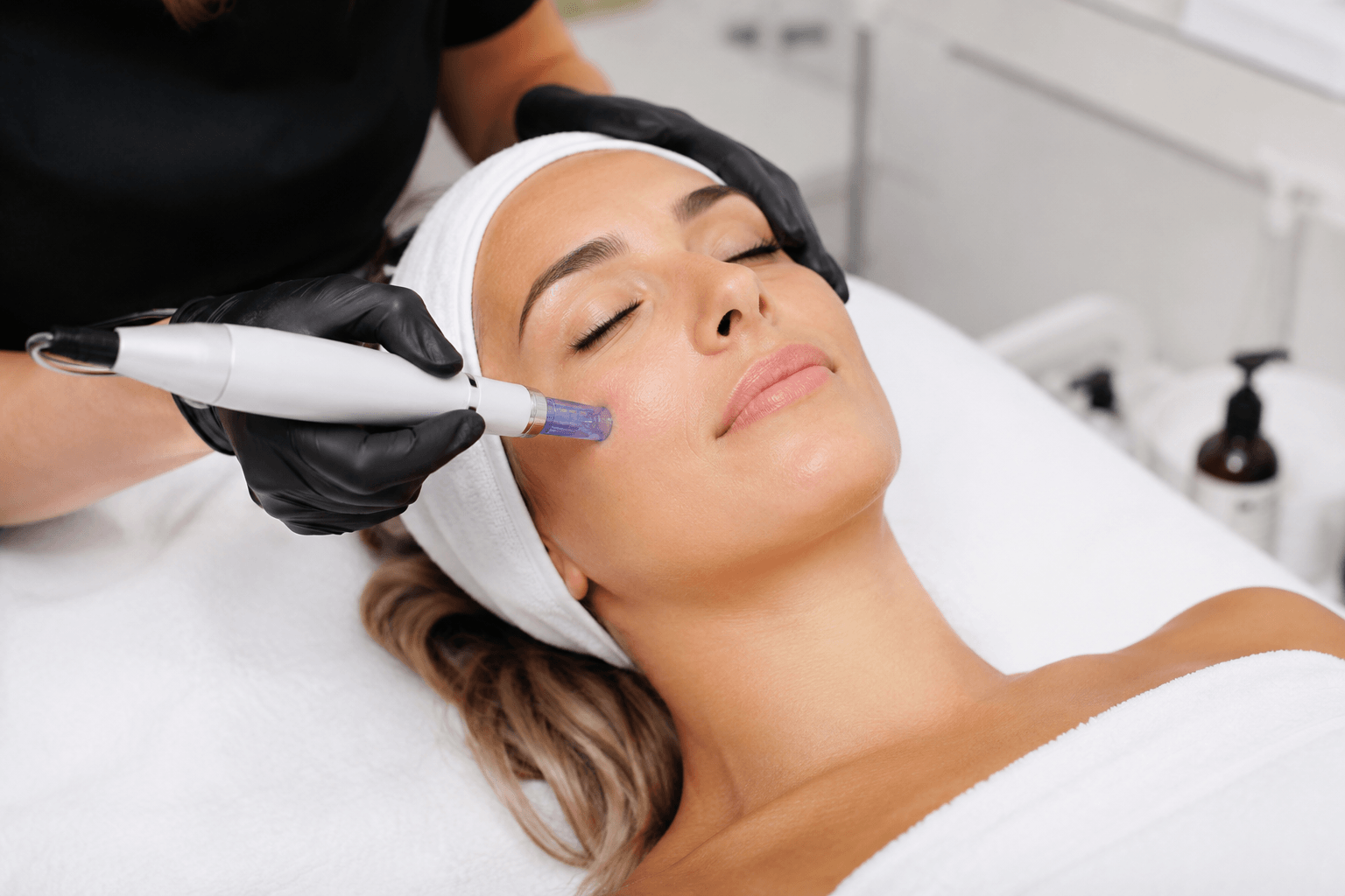 Client receiving radiofrequency microneedling treatment for skin rejuvenation in Pinedale, Wyoming