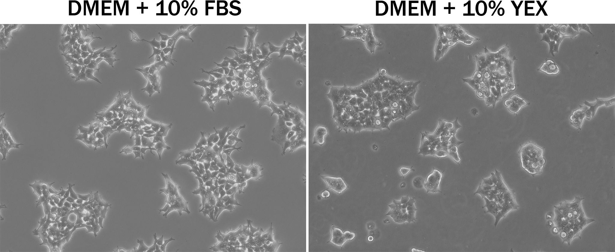 HEK293 cells cultured in YEX, microscopy image