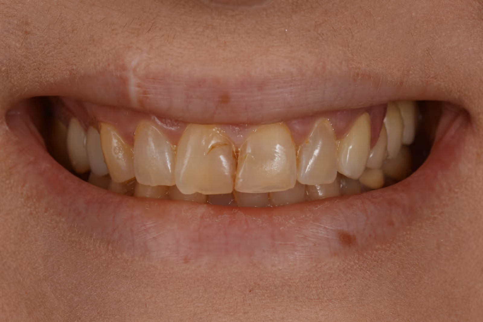 Before Image