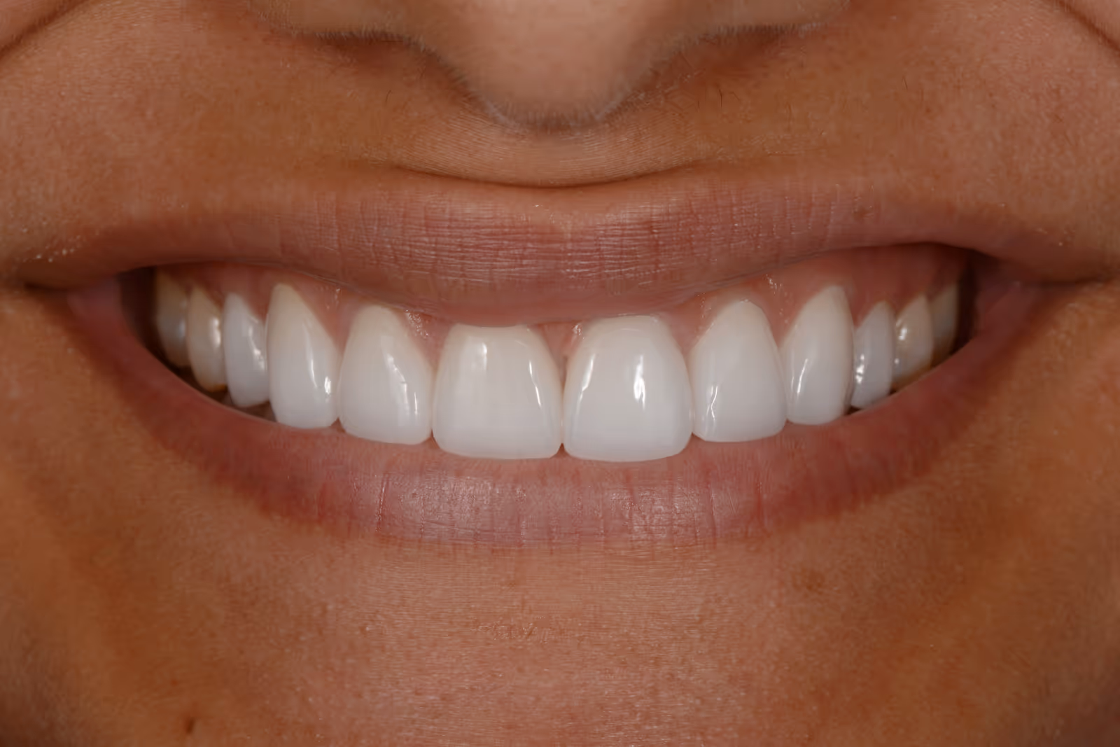 After Image