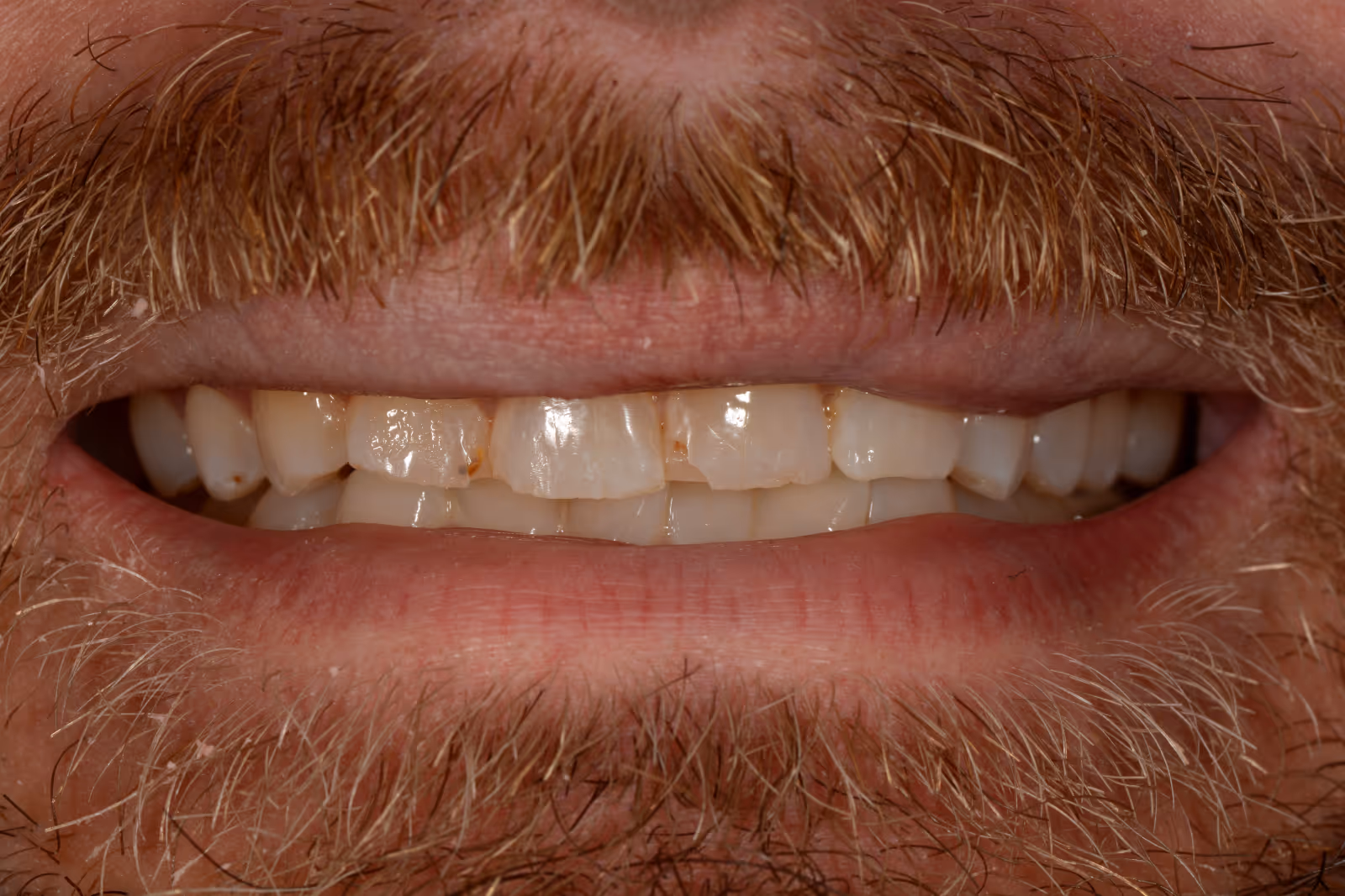Before Image