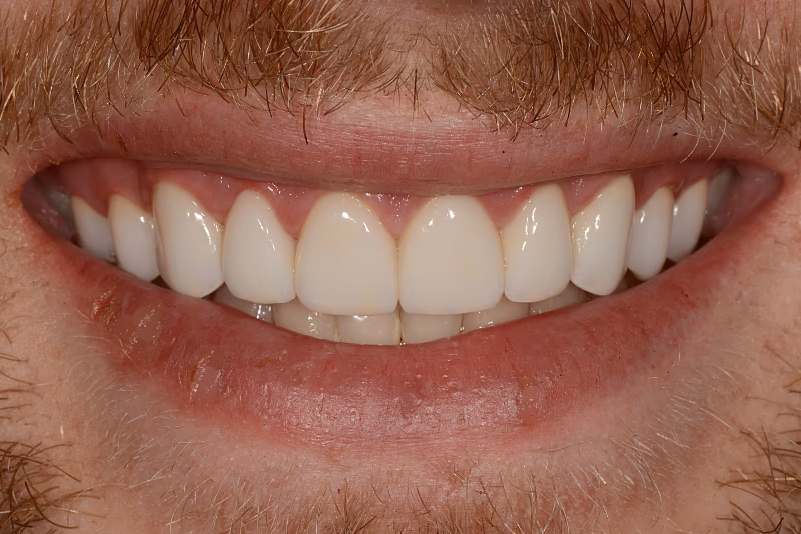 After Image