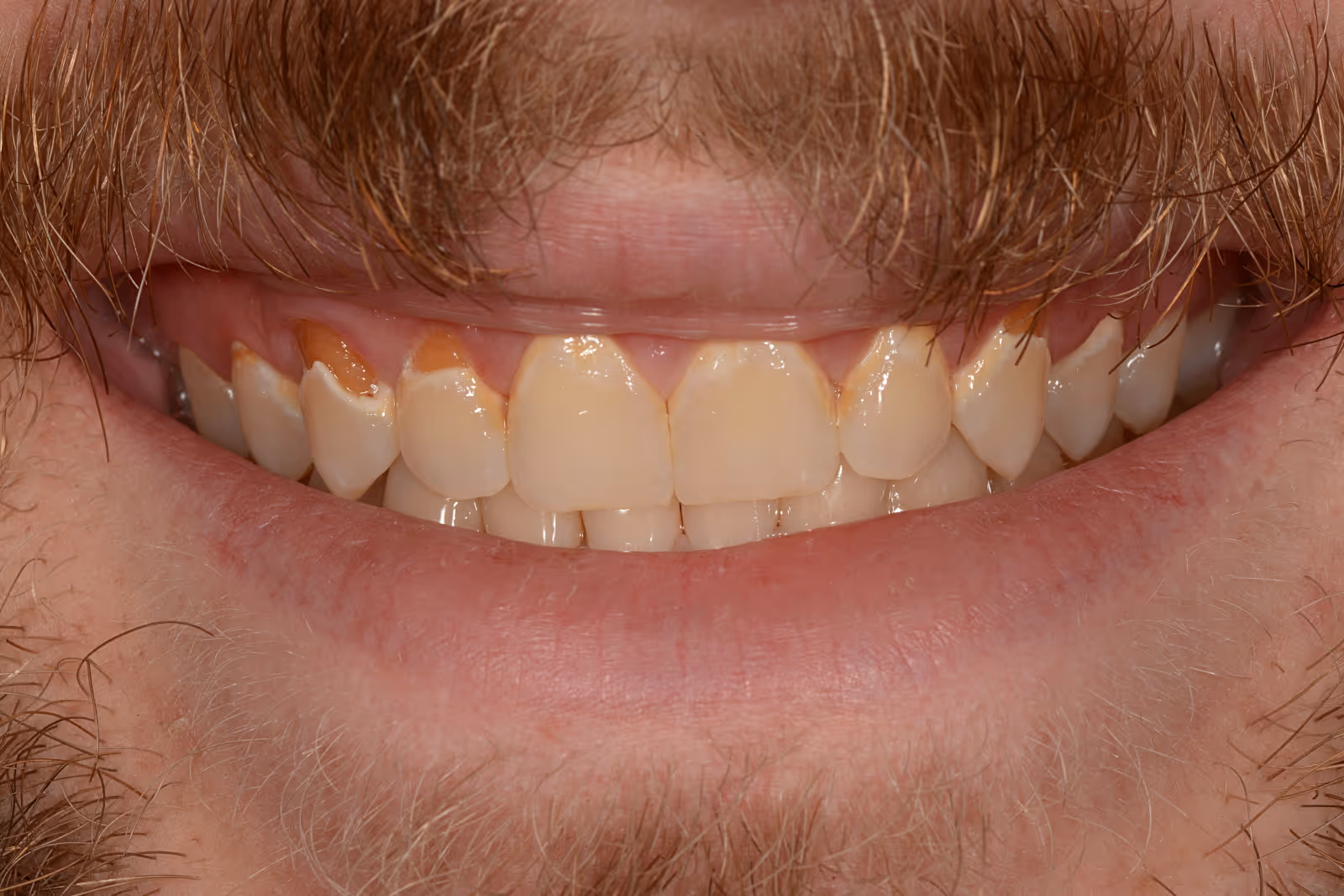 Before Image