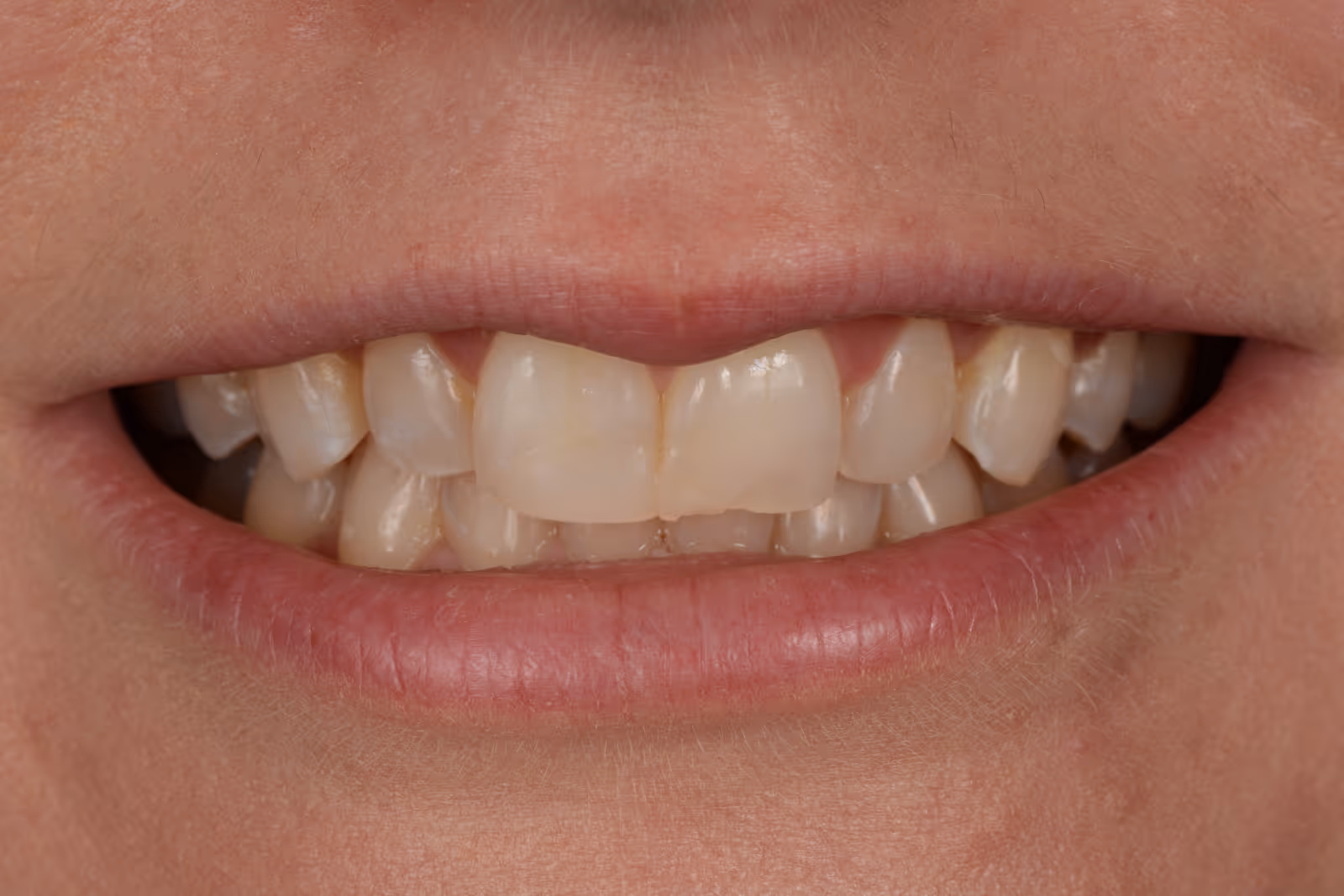 Before Image