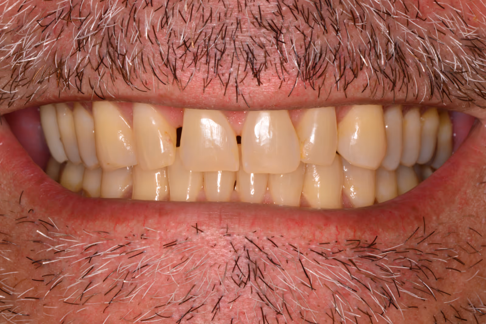 Before Image