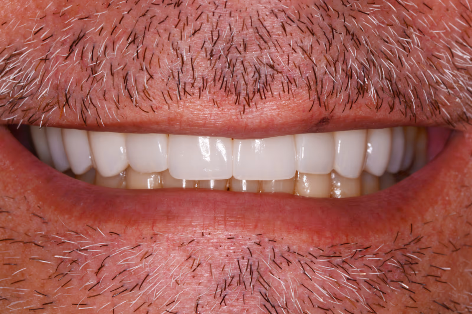 After Image