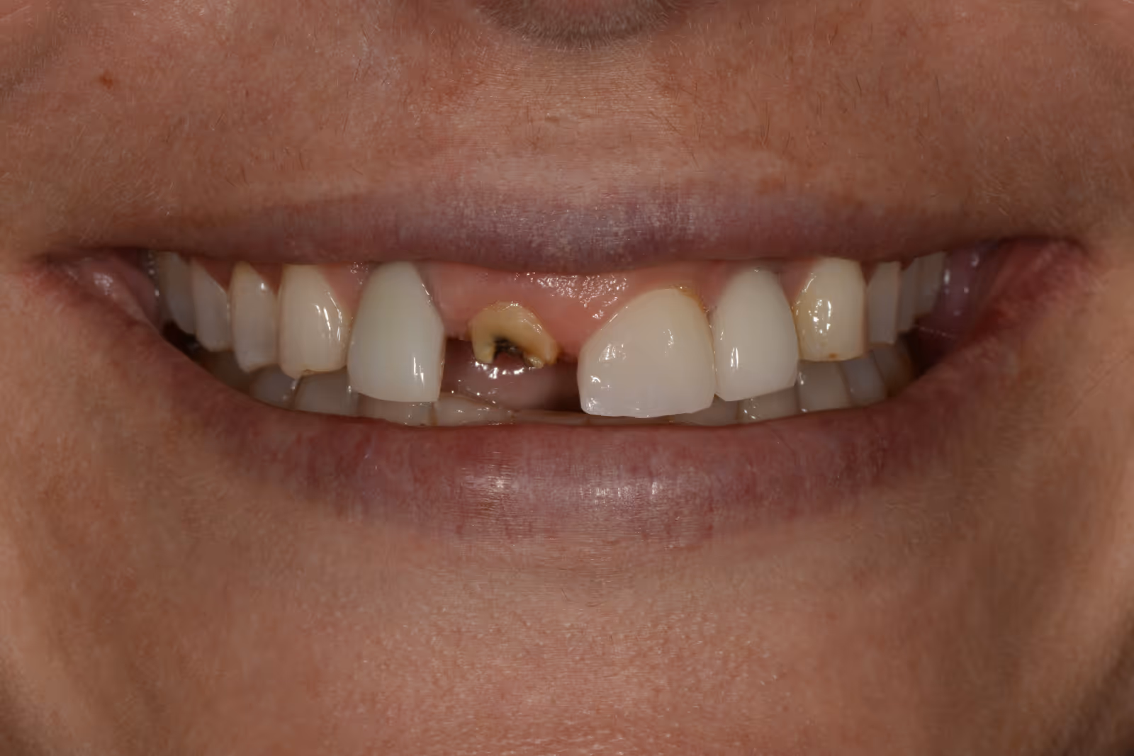 Before Image