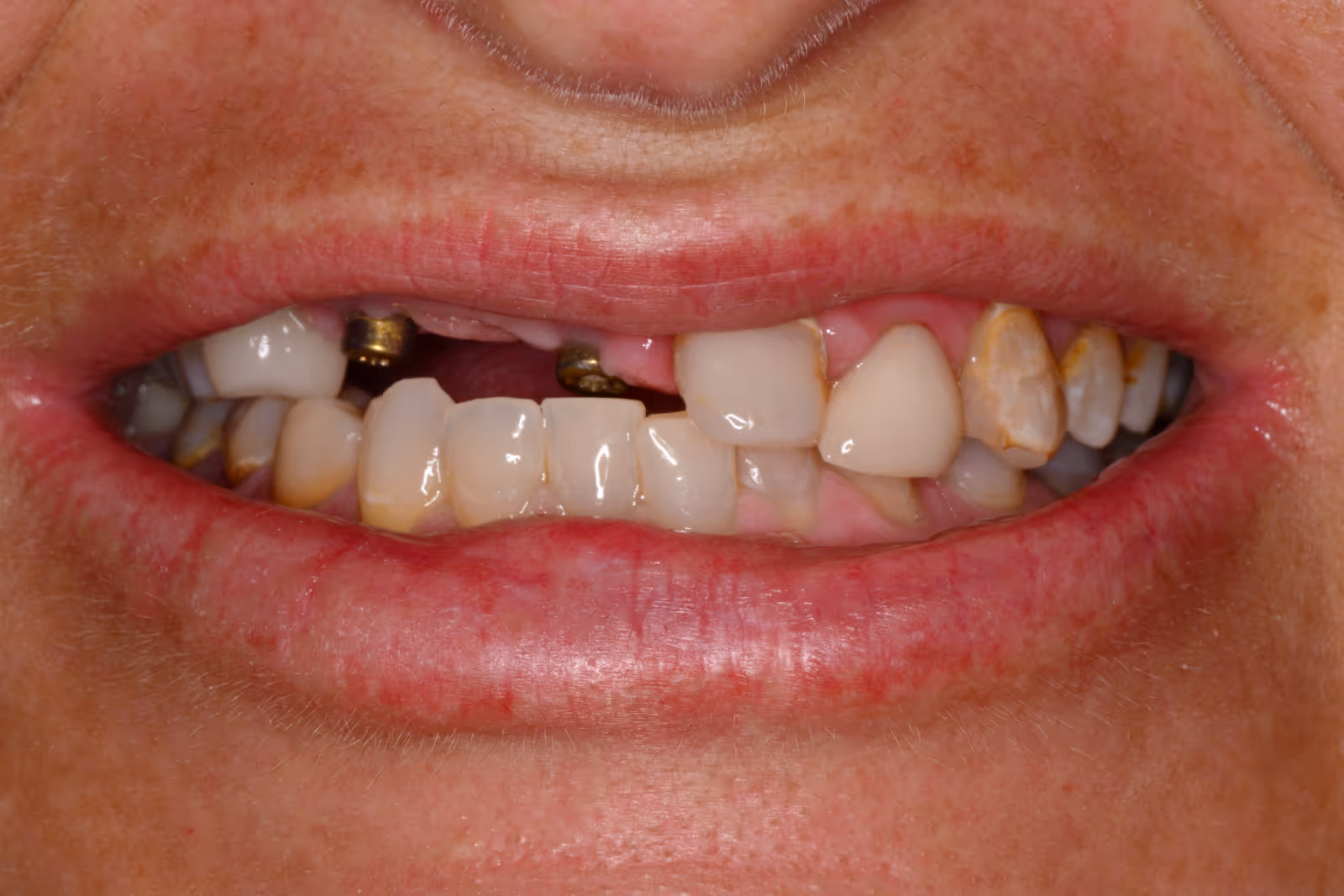 Before Image