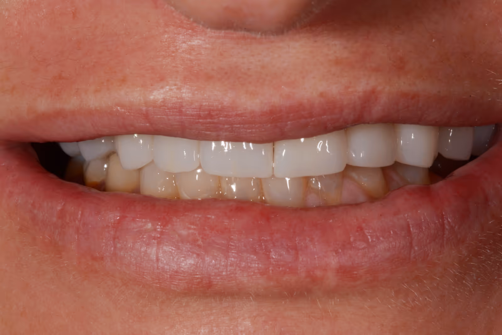 After Image