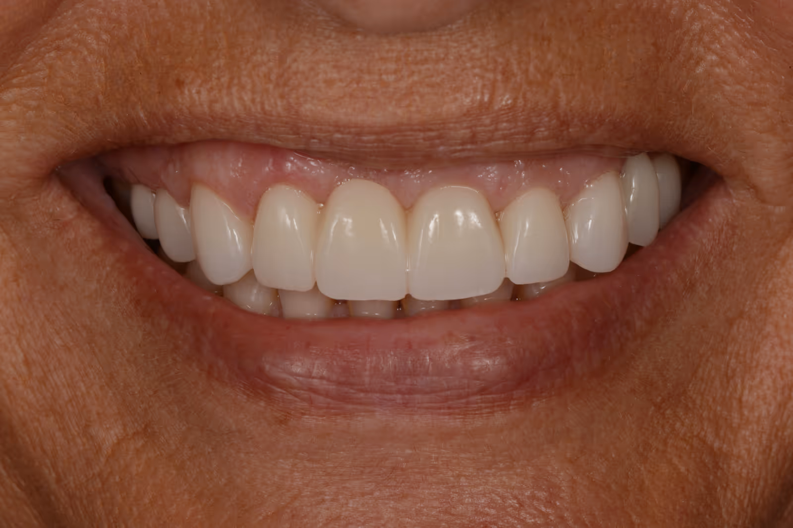 After Image