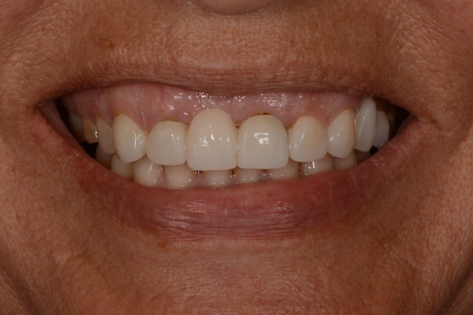 Before Image