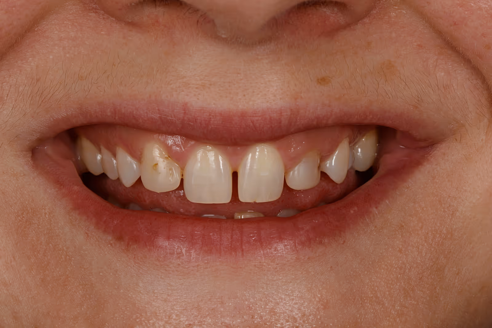 Before Image