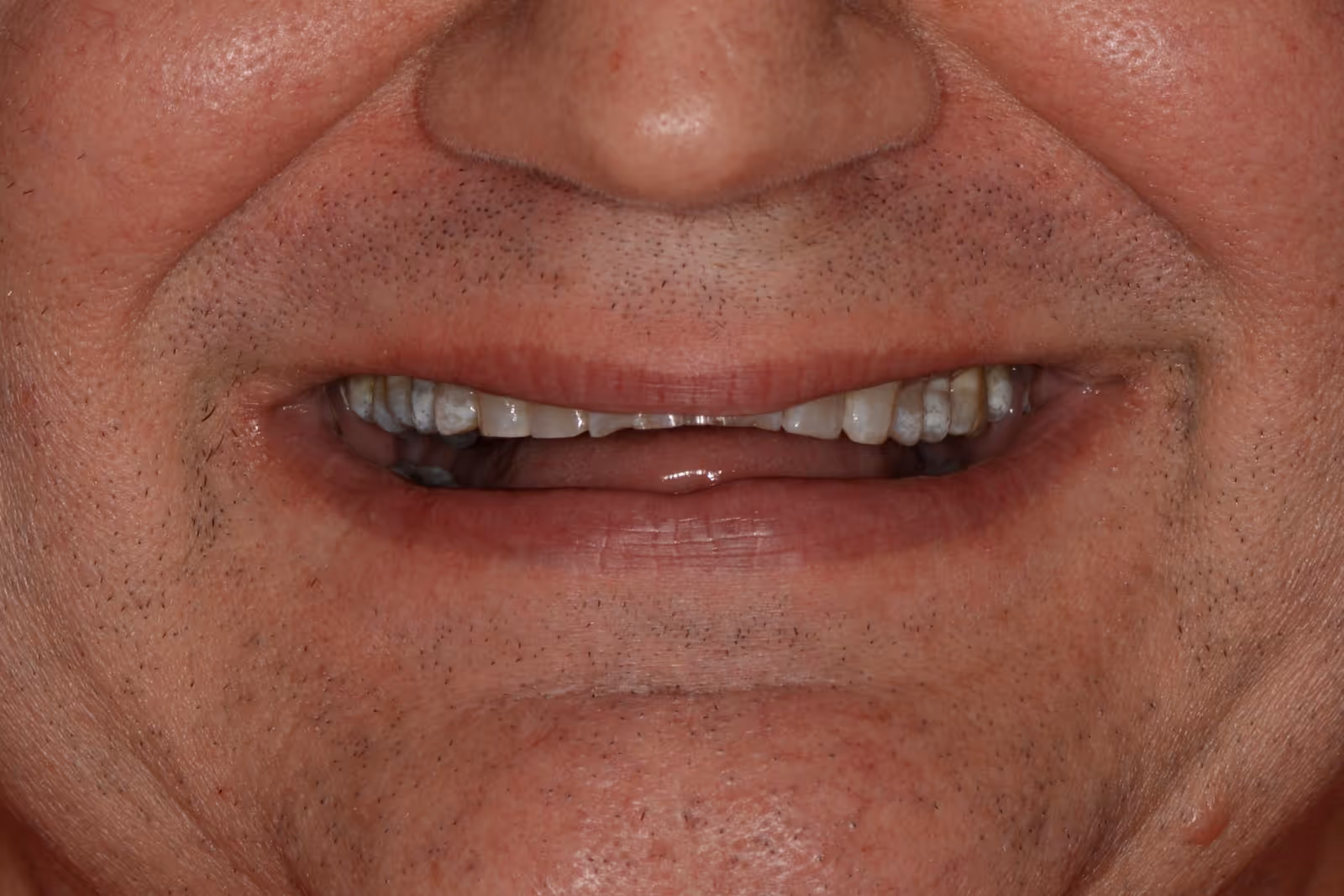 Before Image