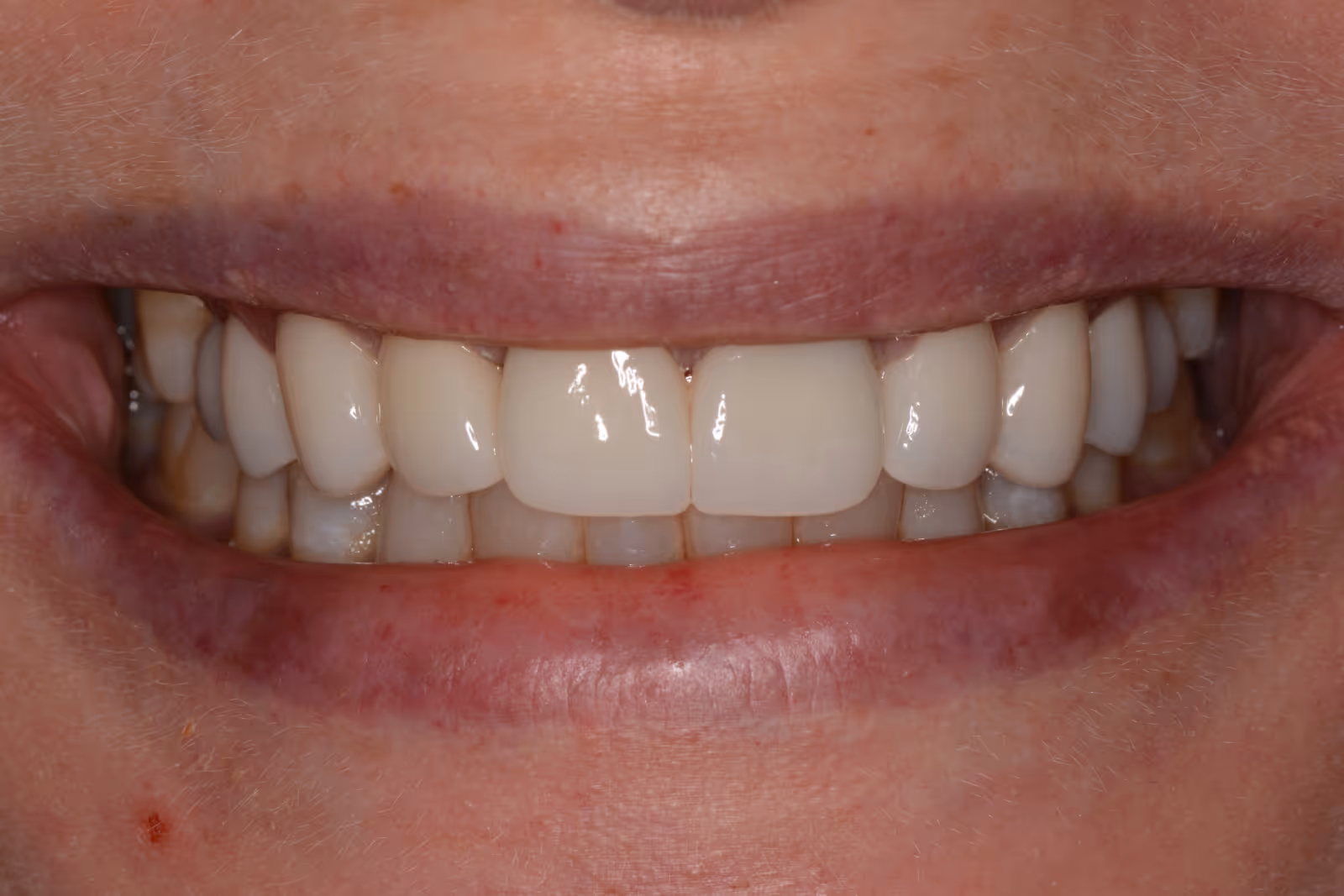 After Image