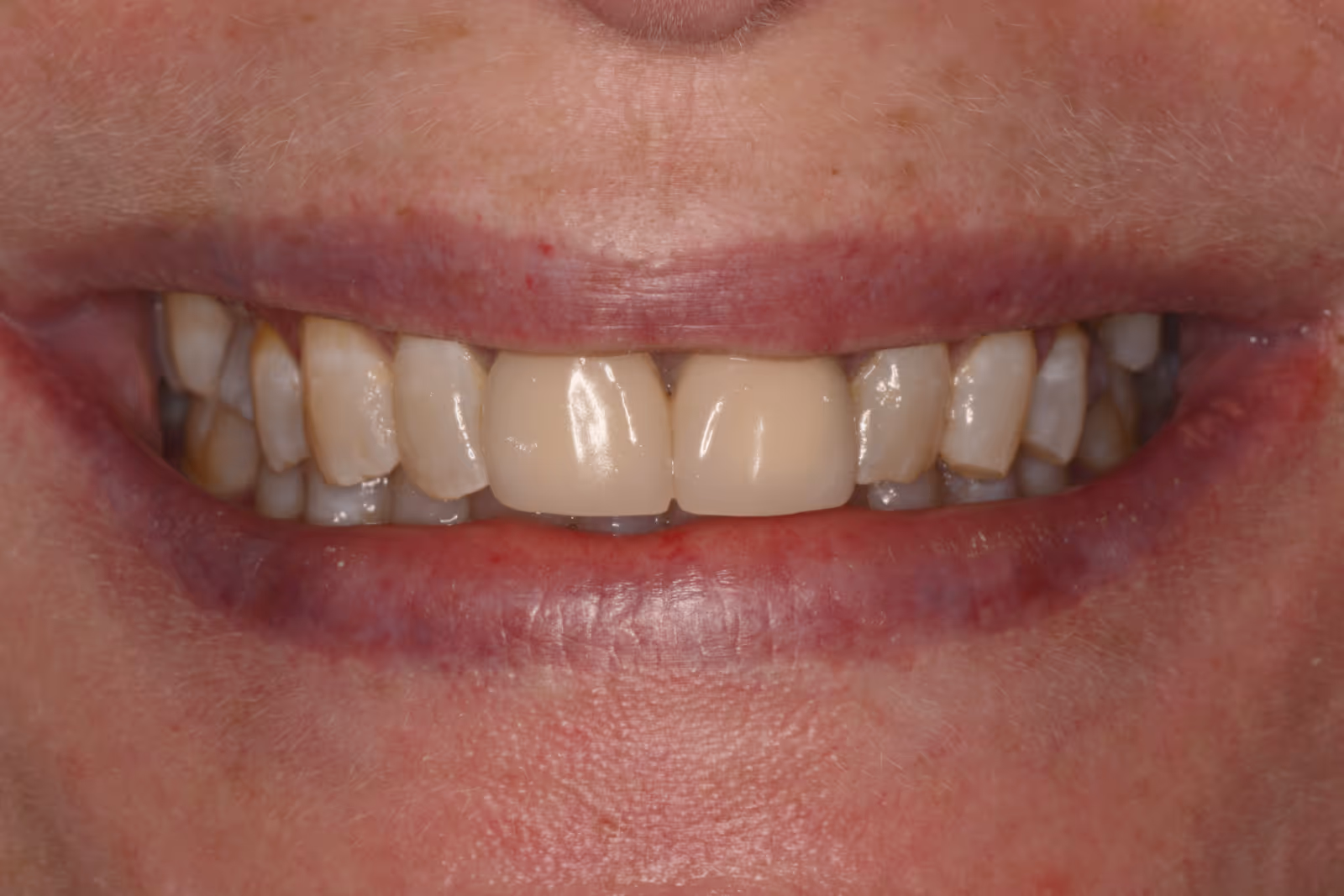 Before Image
