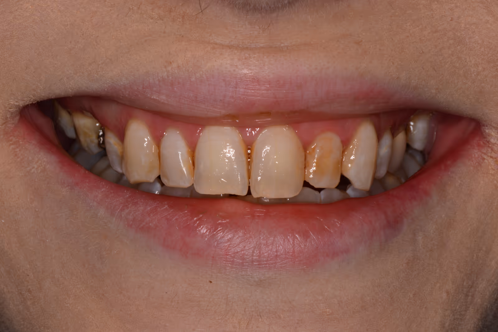 Before Image