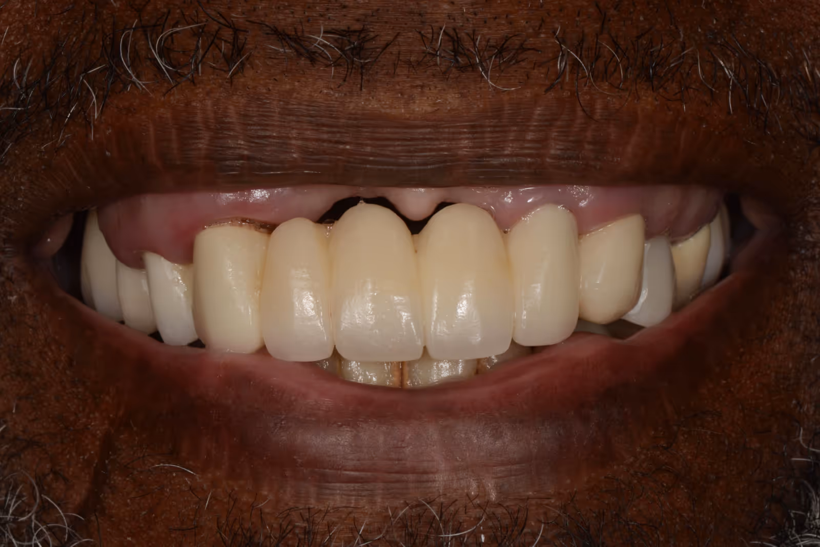Before Image
