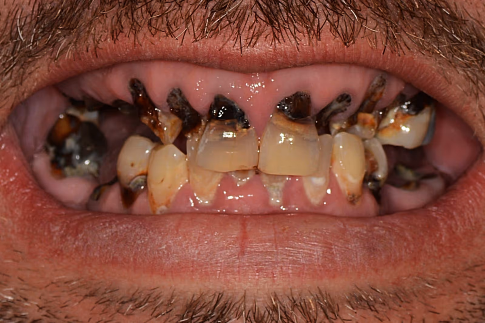 Before Image
