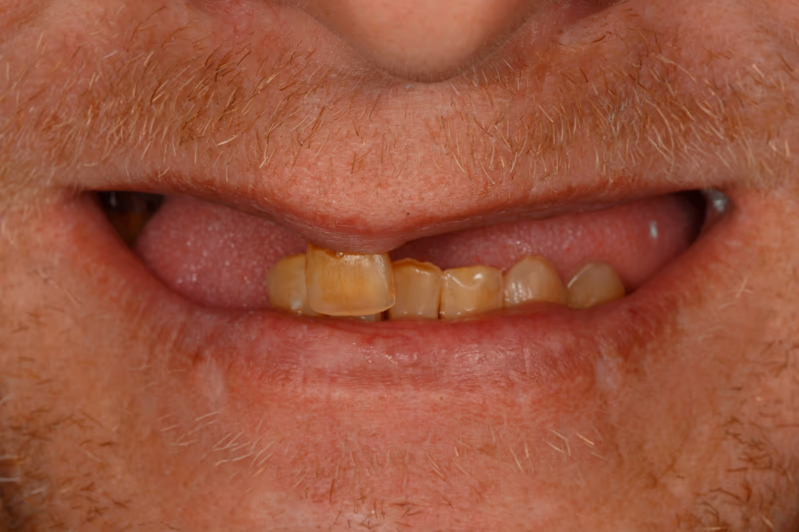 Before Image