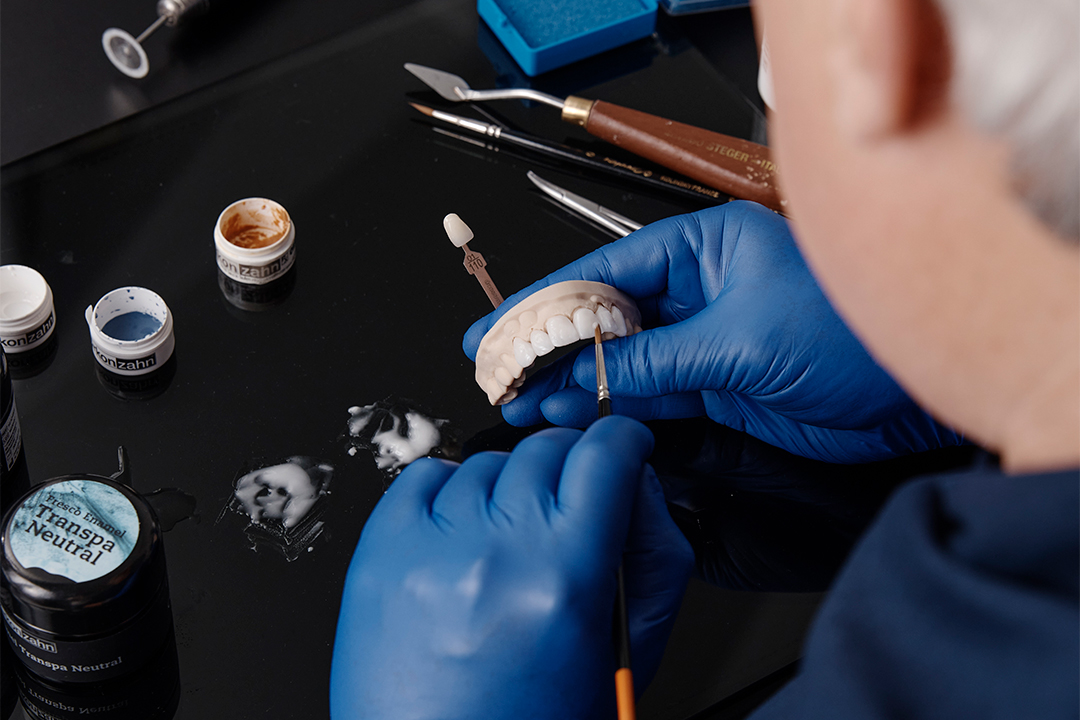 porcelain veneer process