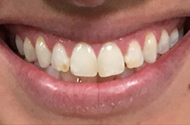 Before