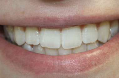 Before
