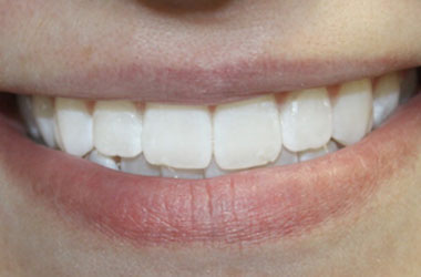 After
