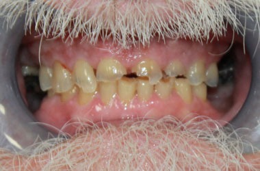 Before