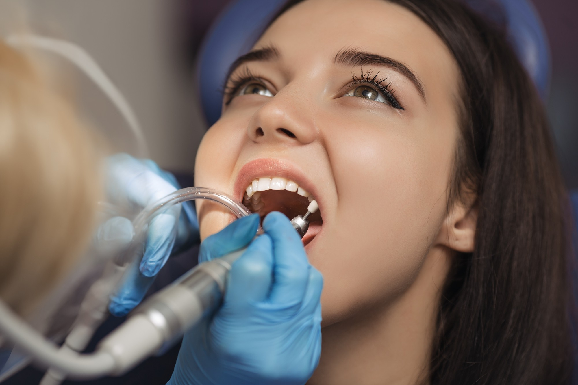 Teeth Cleaning (Deep)