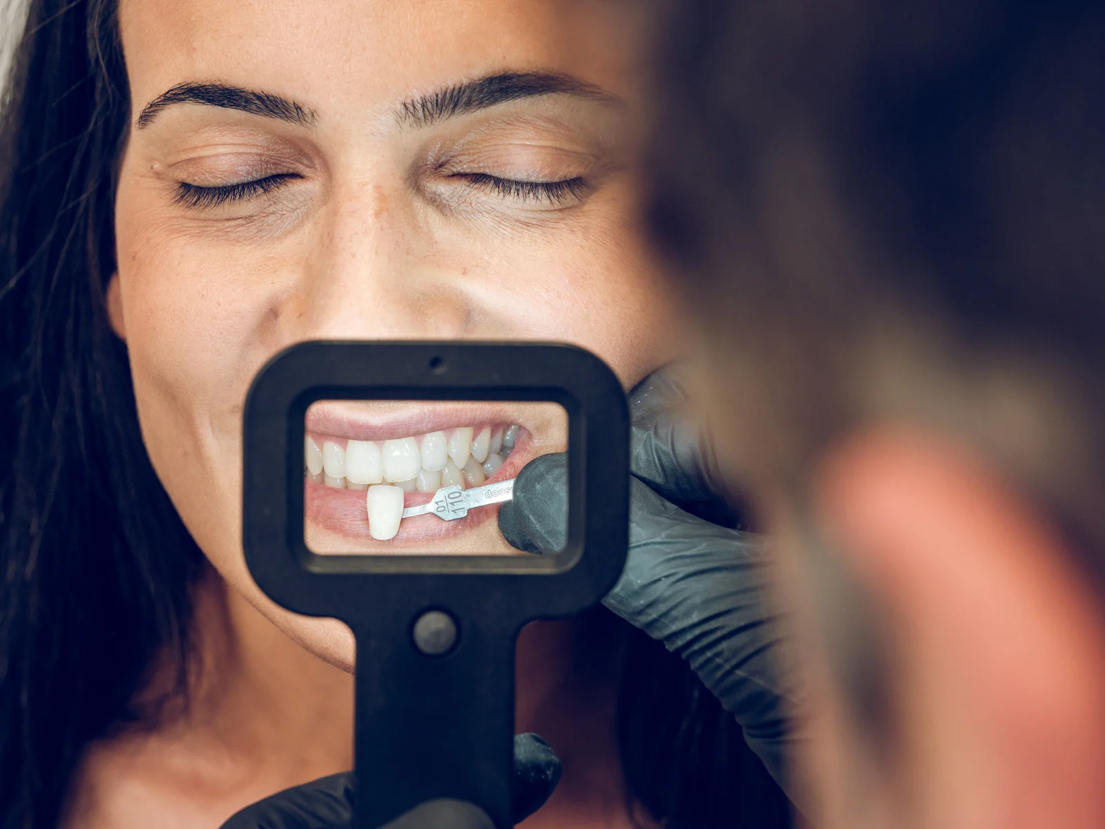 Dentist matching porcelain veneer shade to a patient's teeth at Lotus Dental Studio, Llanelli