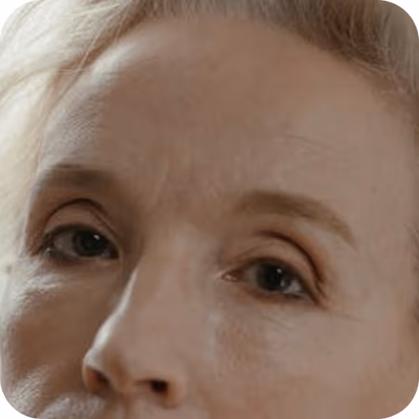 Uneven skin tone and texture