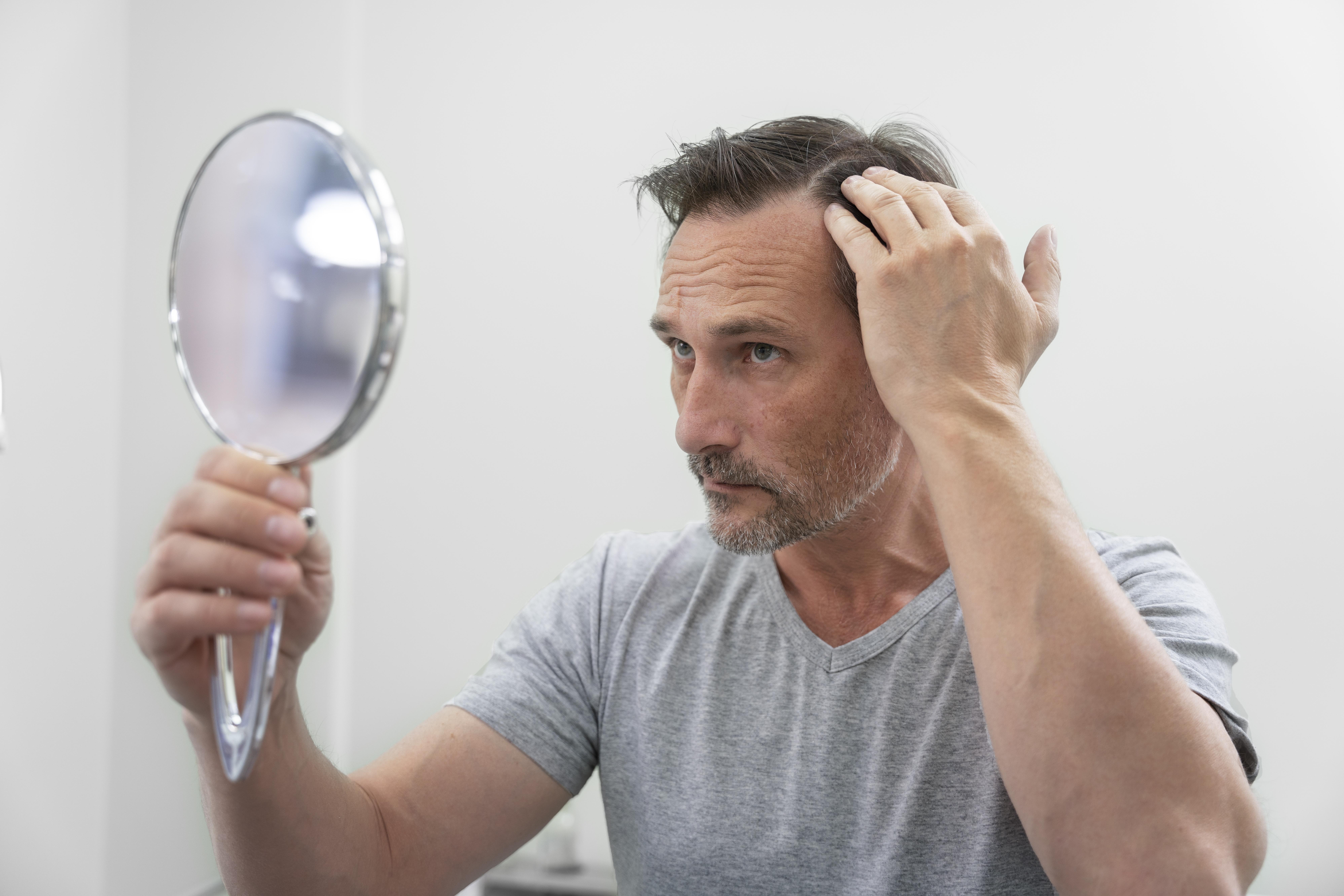 Hair loss and follicle damage