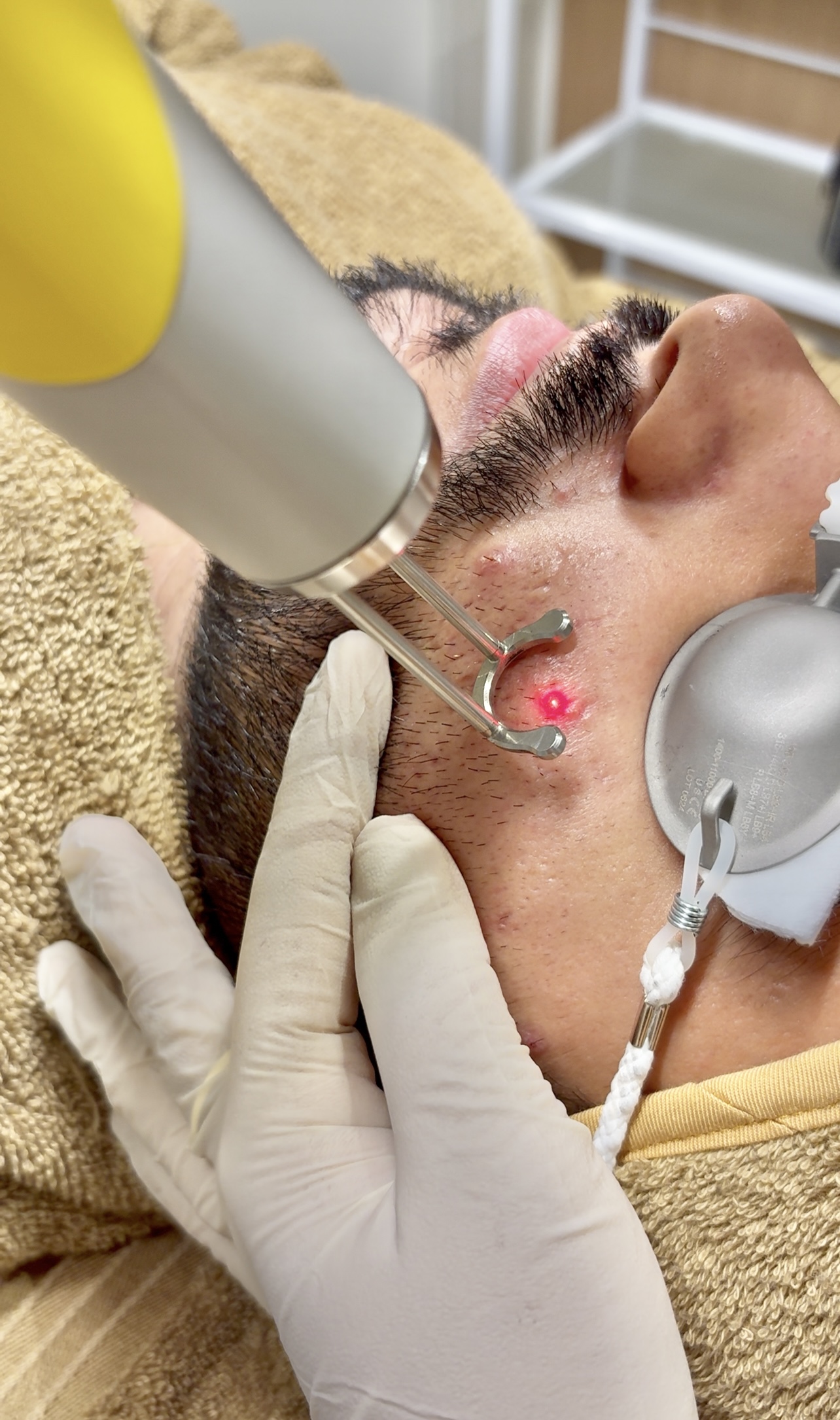 What PICO Laser Can Help With