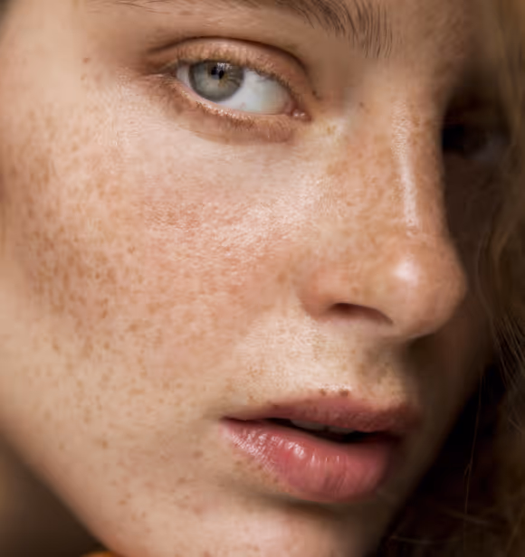 Uneven skin tone and texture