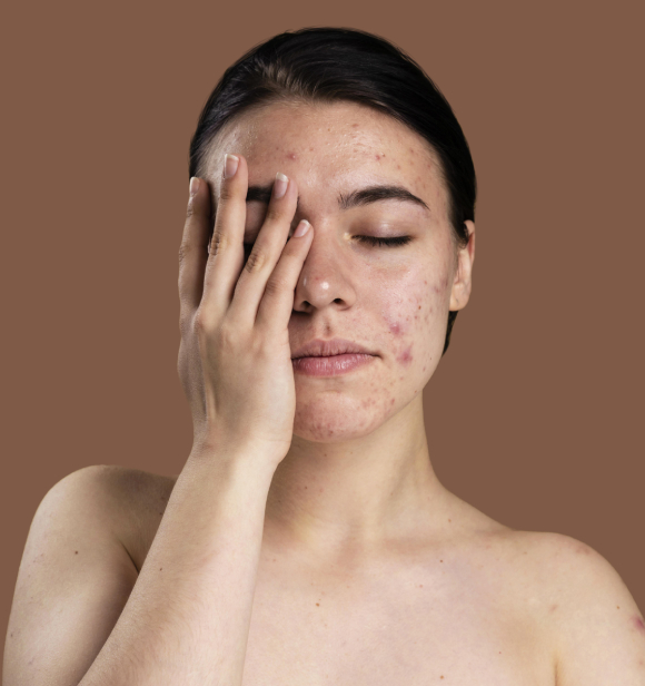 Uneven skin tone and texture