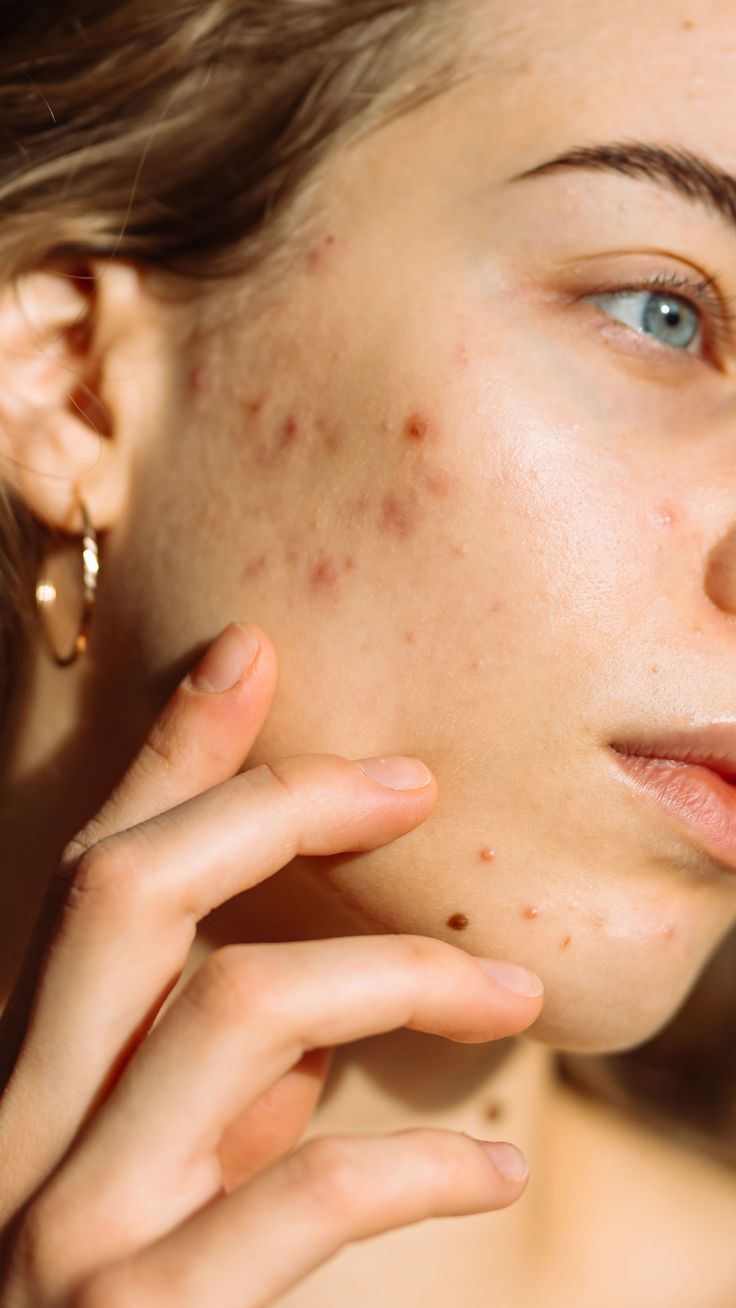 Inflammatory conditions