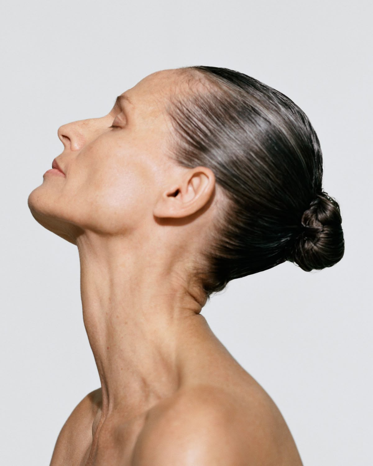 Inflammatory conditions