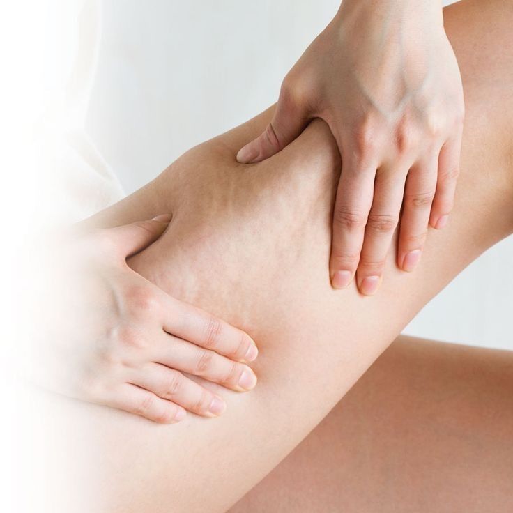 Cellulite and toxin build-up