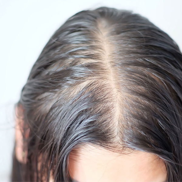 Redness and sensitivity