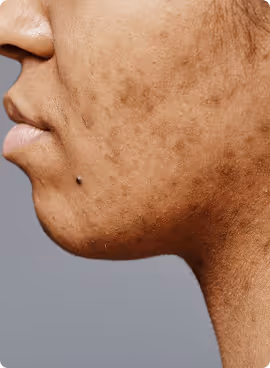 Movement & Fitness Prescription